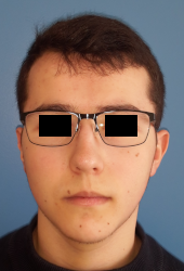 homme de face en post-opératoire