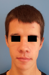 homme de face en post-opératoire